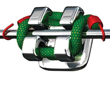 Damon Ceramic Braces