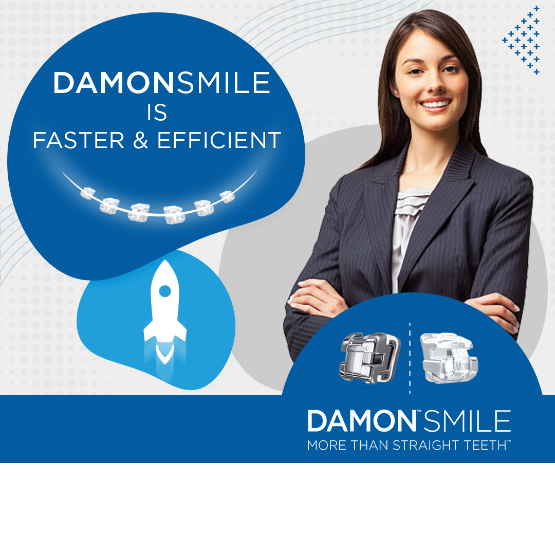 Damon Smile braces