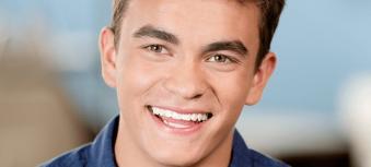 Damon Smile braces